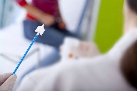 ความก้าวหน้าในการตรวจคัดกรองมะเร็งปากมดลูก: บทบาทของการทดสอบ HPV การสะสมตัวเอง