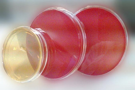 Salmonella Shigella Agar (SS): สื่อที่จำเป็นสำหรับการแยกเชื้อโรค