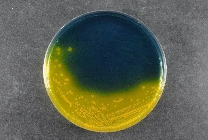 สร้างความมั่นใจในความปลอดภัยของอาหาร: Salmonella Shigella Agar (SS) ของ Babio สนับสนุนมาตรฐานการตรวจจับเชื้อโรคทั่วโลก