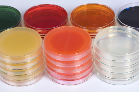 Triple Sugar Iron Iron Agar (TSI): ความแตกต่างที่แม่นยำของ bacilli enteric กับ Babio