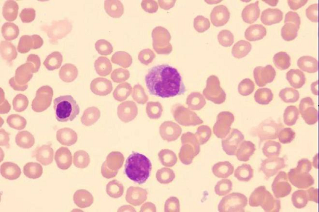 Babio เปิดตัวโซลูชัน Giemsa Stain คุณภาพสูงสำหรับห้องปฏิบัติการทั่วโลก