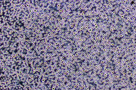 มันฝรั่ง Dextrose Agar (USP) - สื่อที่เชื่อถือได้สำหรับการตรวจจับเชื้อราและยีสต์