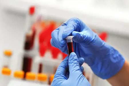 BABIO เปิดตัวชุดทดสอบการตั้งครรภ์แบบรวดเร็วของวัวเรืองแสง