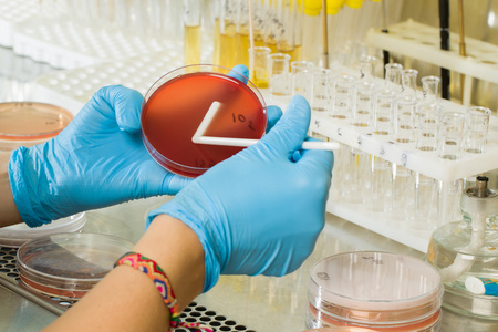 MacConkey Agar Medium ของ BABIO – การแยกแบบคัดเลือกระดับพรีเมียมสำหรับการวินิจฉัยทางจุลชีววิทยาทั่วโลก